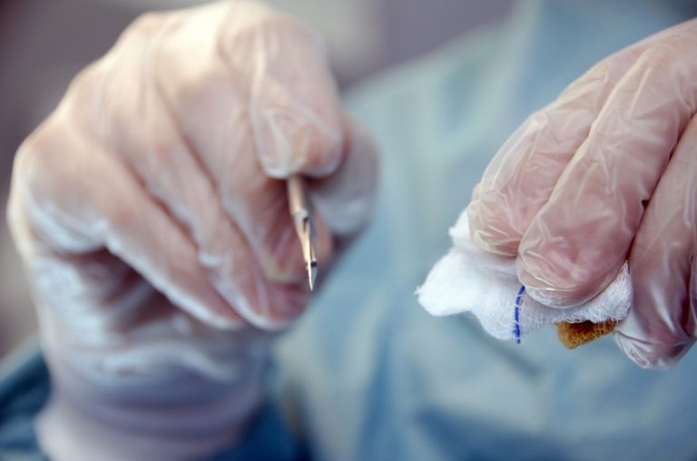 歯科矯正で広がる東京の健康と美を支える最先端ワイヤー治療事情